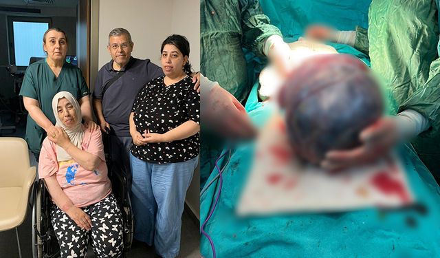 52 Yaşındaki Hastanın Karnından Çıkan Dev Kitle Doktorları Bile Şaşırttı
