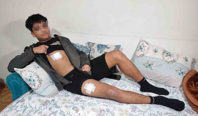 “Bıçağı Yedi” Diye Dalga Geçtiler: Akran Zorbalığında Son Nokta