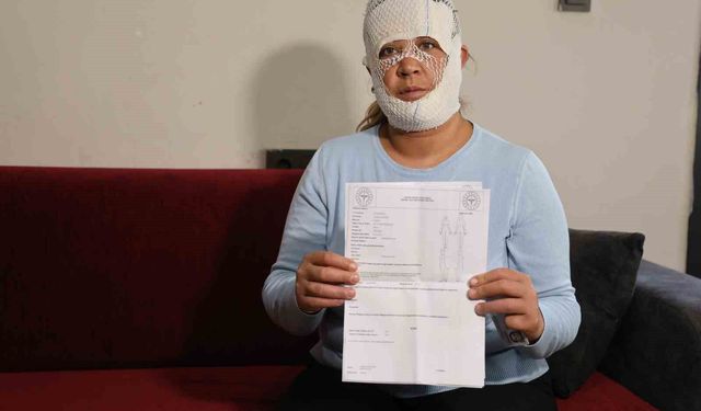 Güzelleşmek İsterken Kabusu Yaşadı! Yüzü Yanıklarla Kaplandı