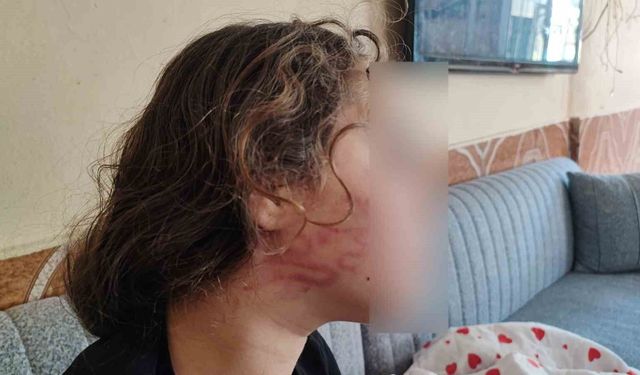 Adana’da Şoke Eden Olay! 11 Yaşındaki Kız Sokak Ortasında Darp Edildi