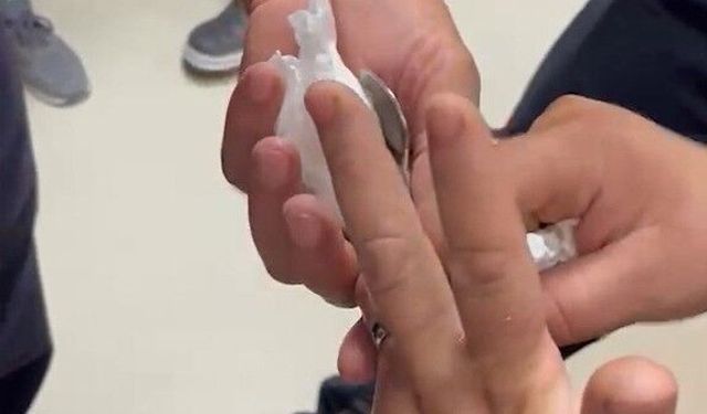 Adana'da Parmağına Sıkışan Yüzük İçin İtfaiye Seferber Oldu!