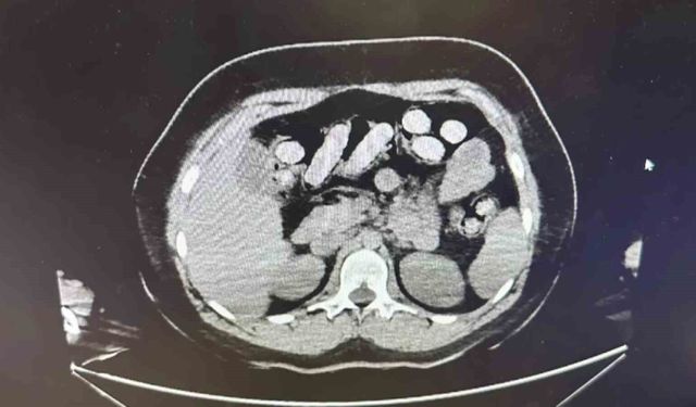 1,5 Kilo Metamfetamini Böyle Taşımışlar!