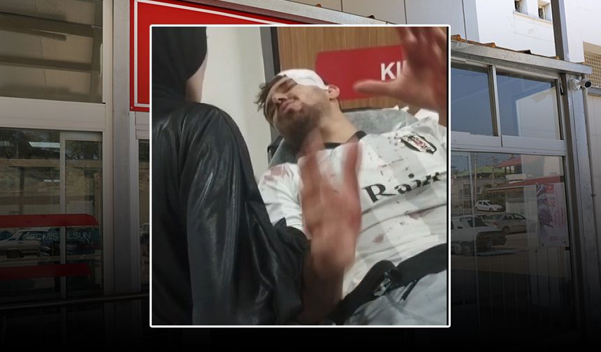 Adana’da Mahalle Maçı Skoru: 2 Yaralı, 1 Sevk, Sıfır Futbol