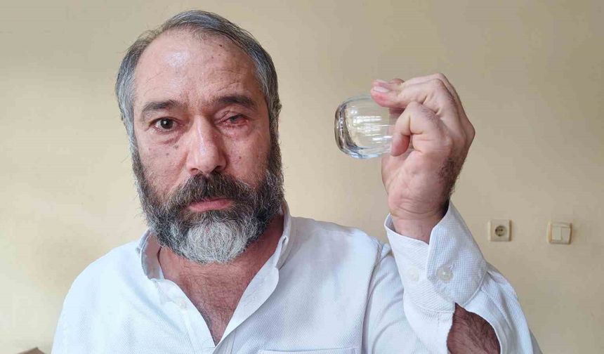 “Uyardım, Gözümden Oldum” Diyen Şoför İsyan Etti