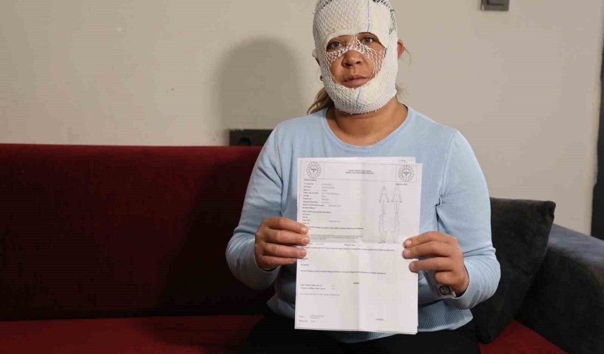 Güzelleşmek İsterken Kabusu Yaşadı! Yüzü Yanıklarla Kaplandı