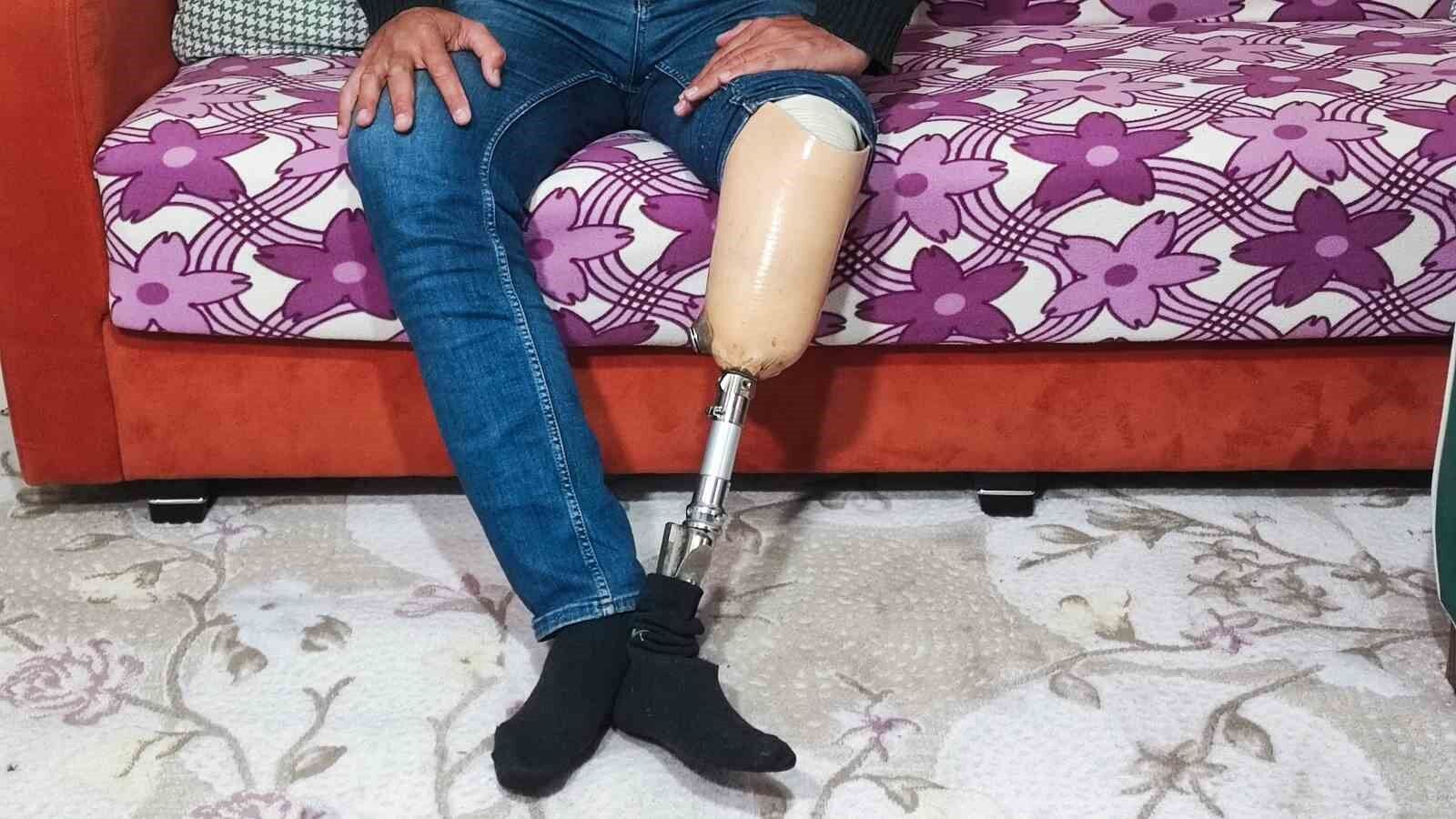 IBAN’ını Verdi, Hayatı Karardı: Protez Bacaklı İşçi Cezaevine Girdi